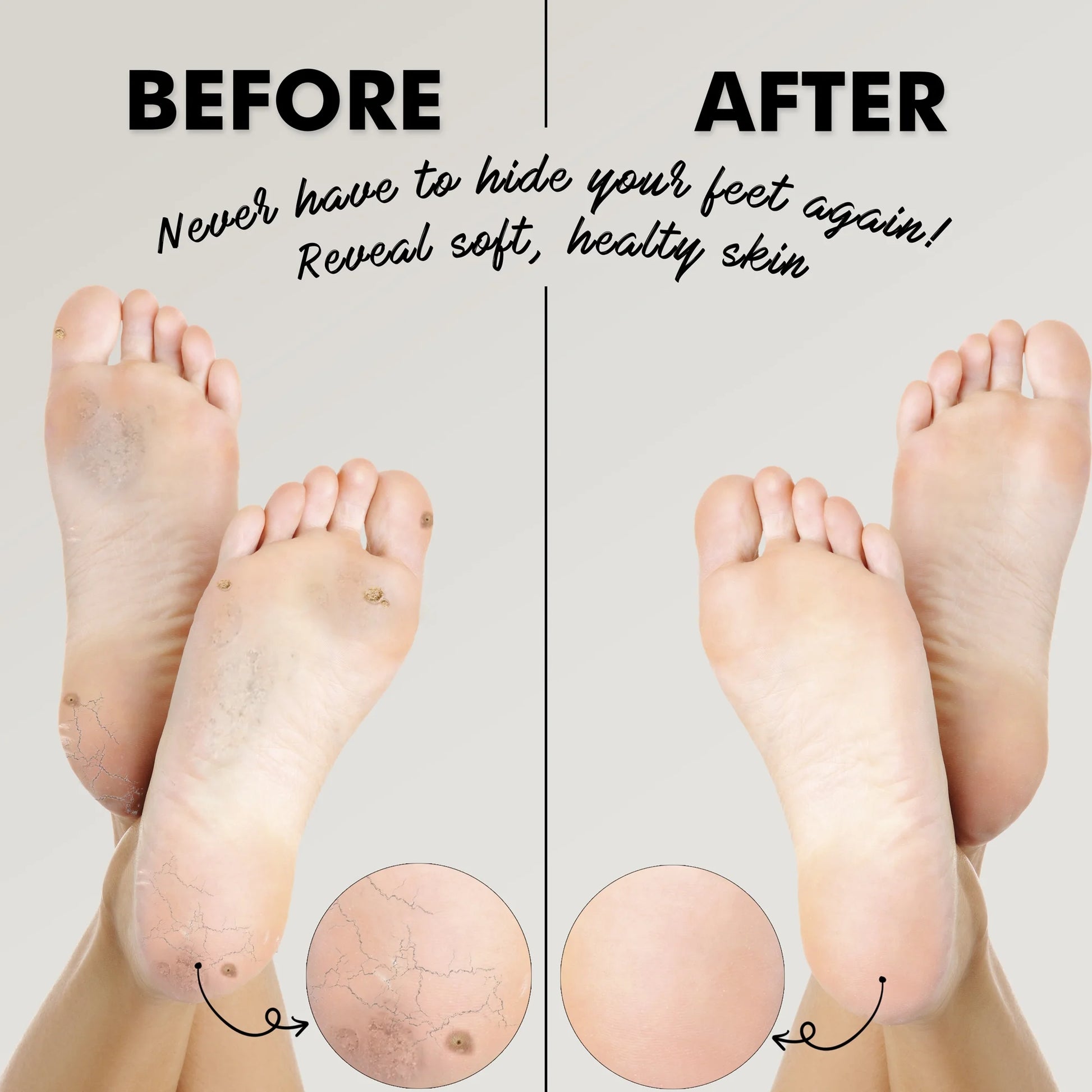Foot Pumice Stone - Lava Stone for Feet Callus - Foot Scrubbers for Use in Shower - Pack of 2